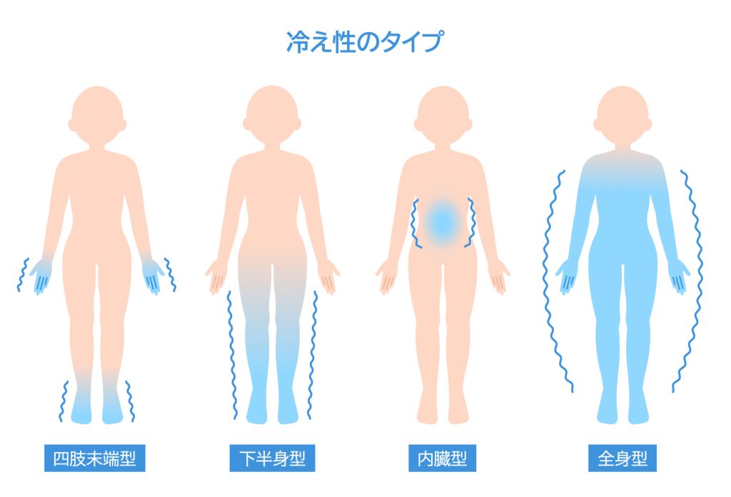 冷え性のタイプイメージ